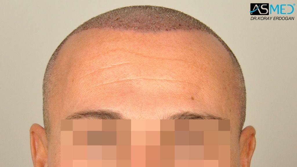 Siccome è veramente possibile aumentare il membro